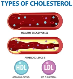 Master the Art of Naturally Lowering Cholesterol for Radiant Skin Health